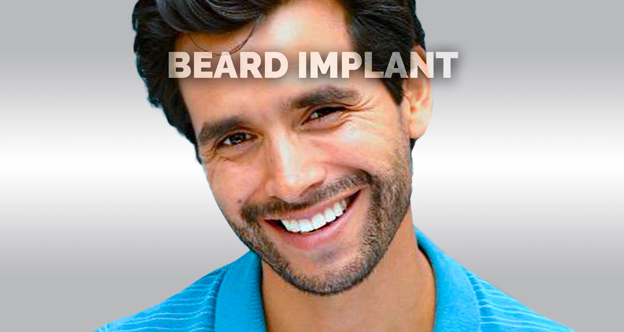 2022-capiland-slide-02-beard-implant-mustache.jpg